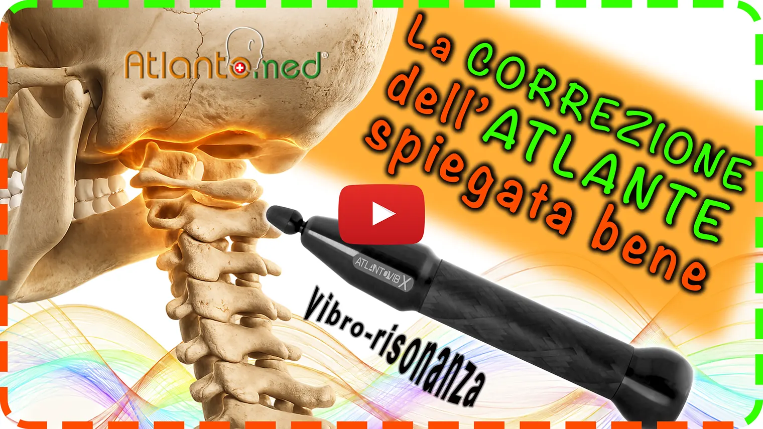 AtlantoMed video Correzione dell'Atlante Correzione dell'Atlante presentazione